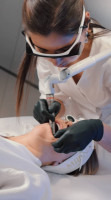 Fotona 4D® - FOTONA-4D