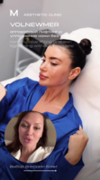 Volnewmer Face Process