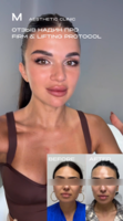 10Therma Nadin Review