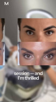 Ellisys Sense® - Illisys-RF