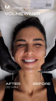 Volnewmer Face result